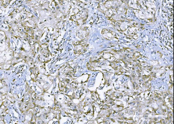 TNF alpha Rabbit Polyclonal Antibody