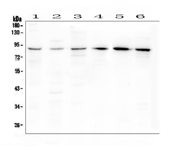 BCL6 Rabbit Polyclonal Antibody