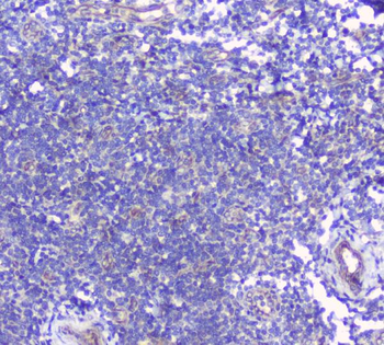 CD272/BTLA Rabbit Polyclonal Antibody