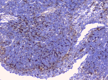 CD272/BTLA Rabbit Polyclonal Antibody