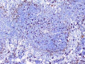 CD272/BTLA Rabbit Polyclonal Antibody