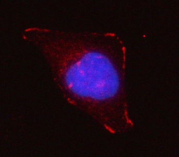 Grancalcin/GCA Rabbit Polyclonal Antibody