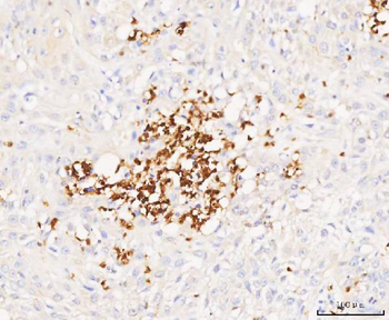 Grancalcin/GCA Rabbit Polyclonal Antibody