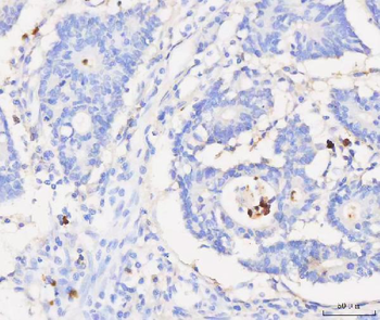 Grancalcin/GCA Rabbit Polyclonal Antibody
