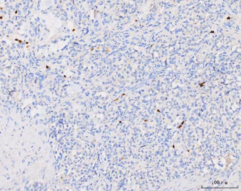 Grancalcin/GCA Rabbit Polyclonal Antibody