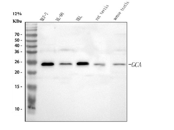 Grancalcin/GCA Rabbit Polyclonal Antibody