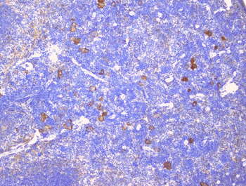 CD229/LY9 Rabbit Polyclonal Antibody