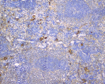 CD229/LY9 Rabbit Polyclonal Antibody