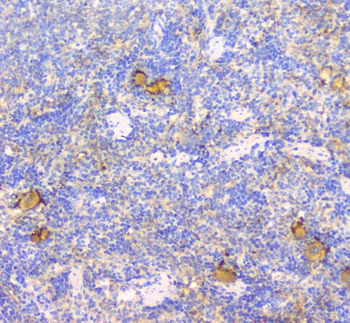 CD229/LY9 Rabbit Polyclonal Antibody