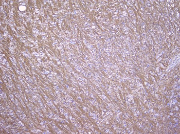 Myelin oligodendrocyte glycoprotein/MOG Rabbit Polyclonal Antibody