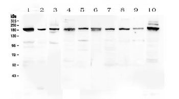 PCDH15 Rabbit Polyclonal Antibody