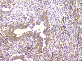 PCDH15 Rabbit Polyclonal Antibody