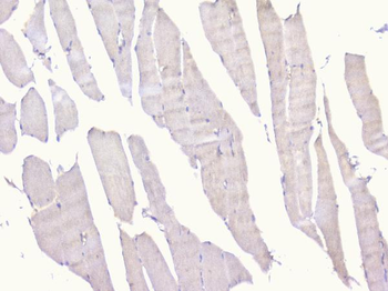 PCDH15 Rabbit Polyclonal Antibody