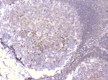 PCDH15 Rabbit Polyclonal Antibody