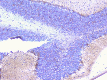 PCDH15 Rabbit Polyclonal Antibody