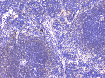 PCDH15 Rabbit Polyclonal Antibody