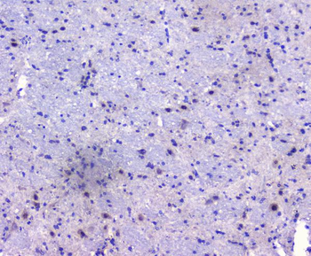 PCDH15 Rabbit Polyclonal Antibody