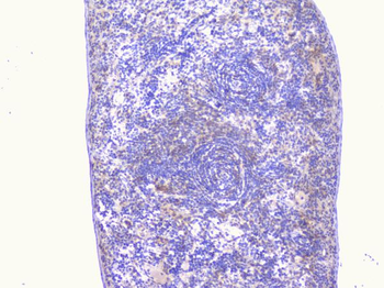 PCDH15 Rabbit Polyclonal Antibody