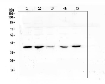 uPA Receptor/PLAUR Rabbit Polyclonal Antibody
