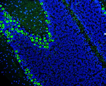 PKC gamma/PRKCG Rabbit Polyclonal Antibody