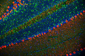 PKC gamma/PRKCG Rabbit Polyclonal Antibody