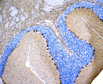 PKC gamma/PRKCG Rabbit Polyclonal Antibody