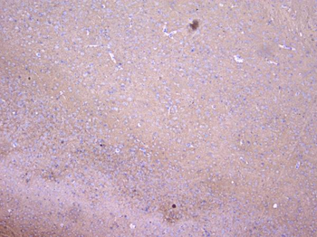 PKC gamma/PRKCG Rabbit Polyclonal Antibody