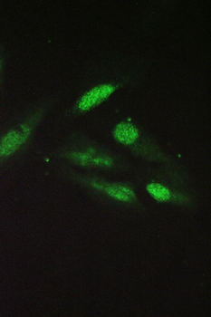 SRI Rabbit Polyclonal Antibody