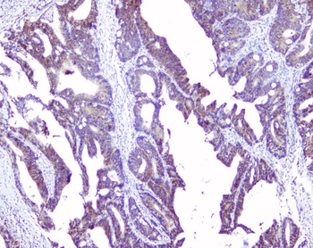 SRI Rabbit Polyclonal Antibody