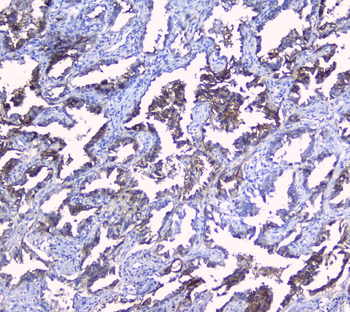 SRI Rabbit Polyclonal Antibody