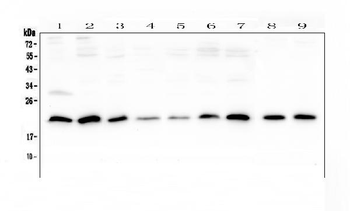 SRI Rabbit Polyclonal Antibody