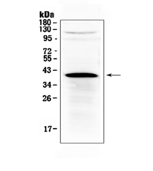 HSD17B1 Rabbit Polyclonal Antibody