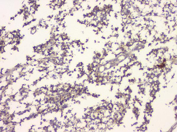 APP/C99 Antibody