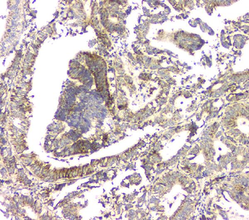 Aprt Rabbit Polyclonal Antibody