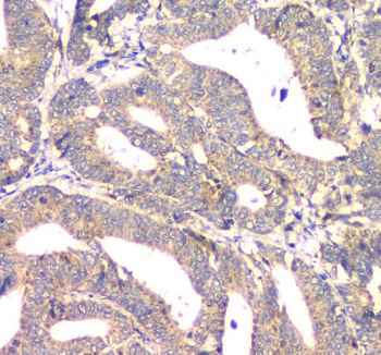 Aprt Rabbit Polyclonal Antibody