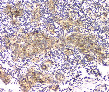 Aprt Rabbit Polyclonal Antibody