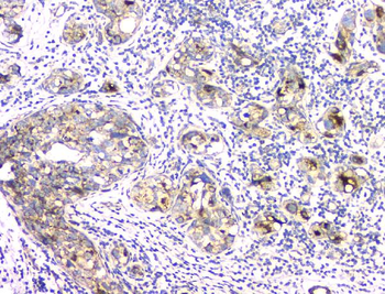Aprt Rabbit Polyclonal Antibody