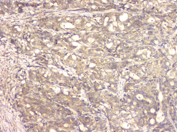 BMP15 Antibody