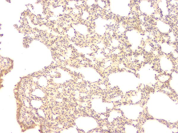 BMP15 Antibody