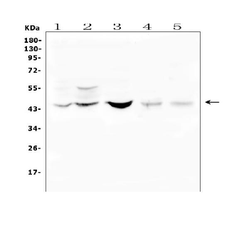 BMP15 Antibody