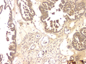 BMP15 Antibody