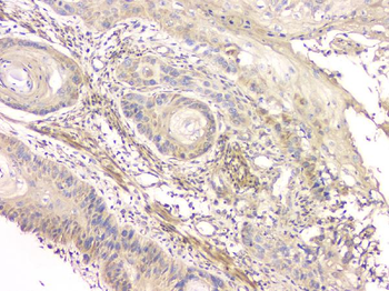 GPR2/CCR10 Rabbit Polyclonal Antibody