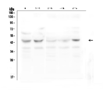 GPR2/CCR10 Rabbit Polyclonal Antibody