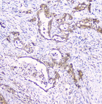 CDA Rabbit Polyclonal Antibody