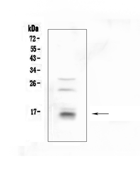 CDA Rabbit Polyclonal Antibody