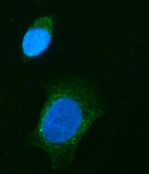 CHM Rabbit Polyclonal Antibody
