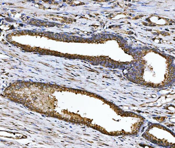 CHM Rabbit Polyclonal Antibody
