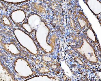 CHM Rabbit Polyclonal Antibody
