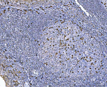 CHM Rabbit Polyclonal Antibody