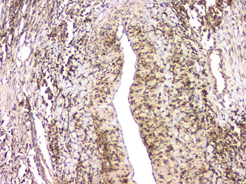 HECTD3 Rabbit Polyclonal Antibody
